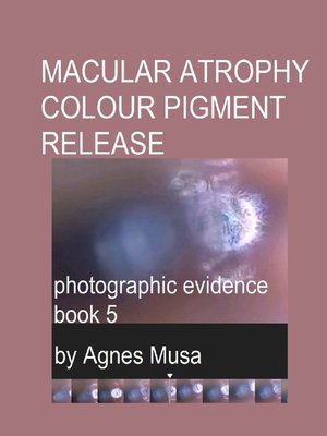 cover image of Macular Atrophy Colour Pigment Release, Photographic Evidence Book 5